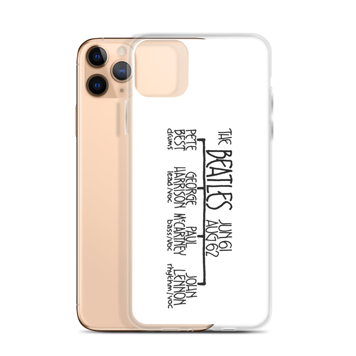 Pete Best's Beatles | iPhone case